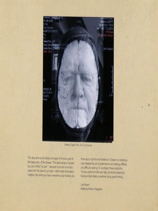 Finding Parkinson's: Doing Battle with My Brain